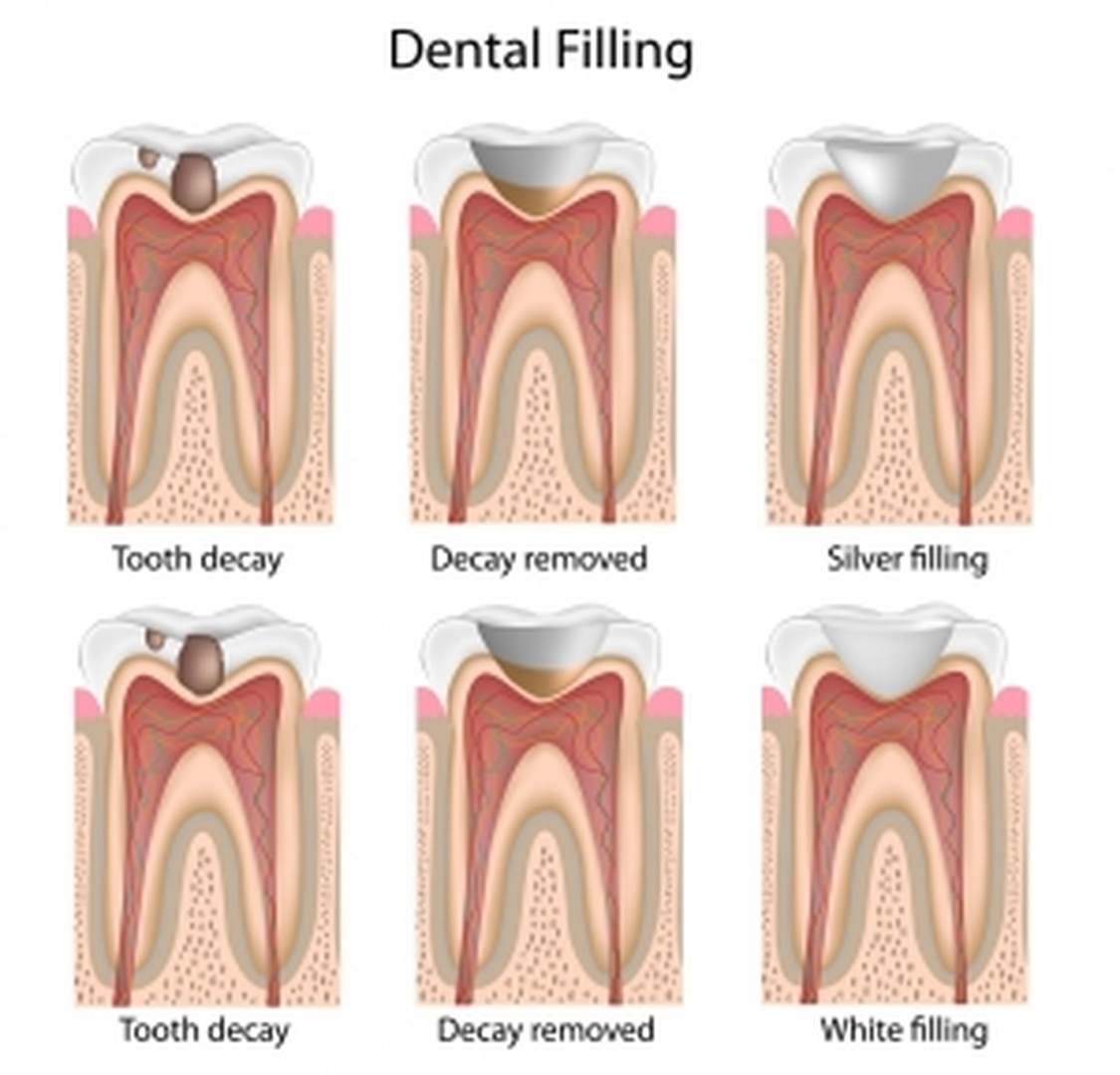 Smile High Dental Care Image