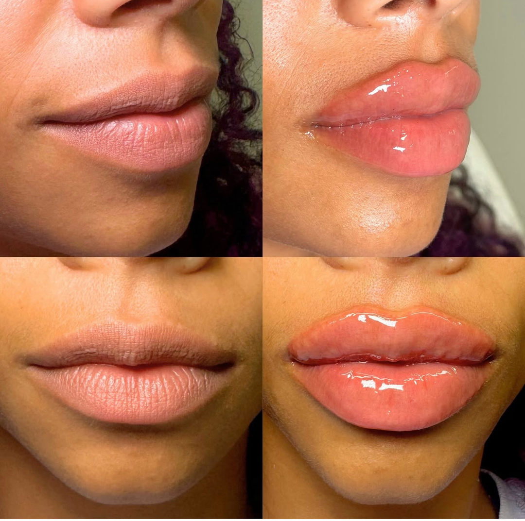 HydraHive IV and Med Spa Image