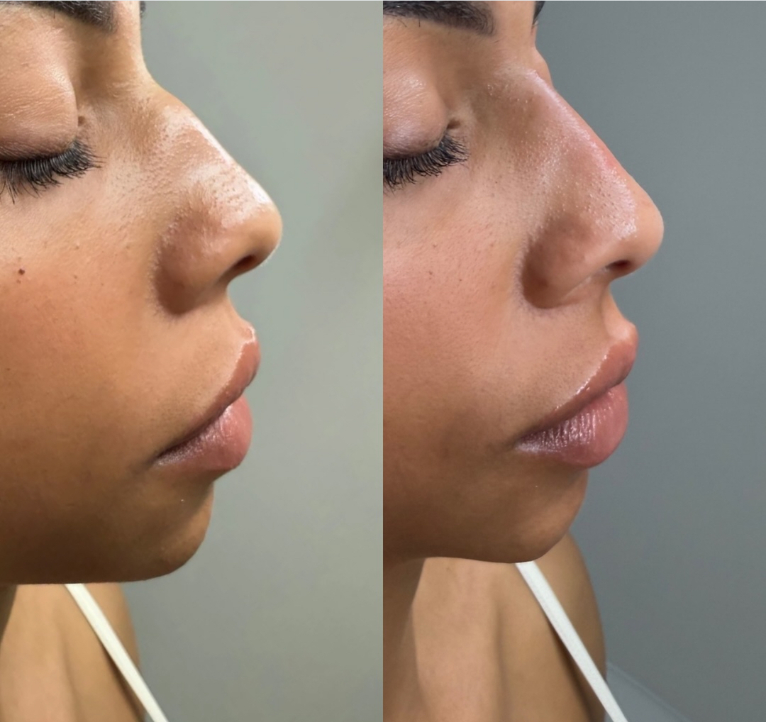 HydraHive IV and Med Spa Image