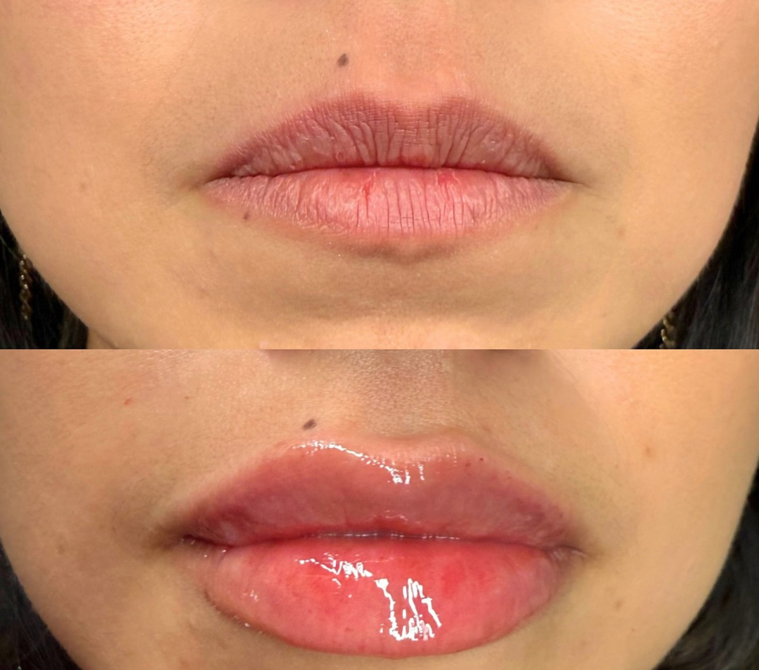 HydraHive IV and Med Spa Image