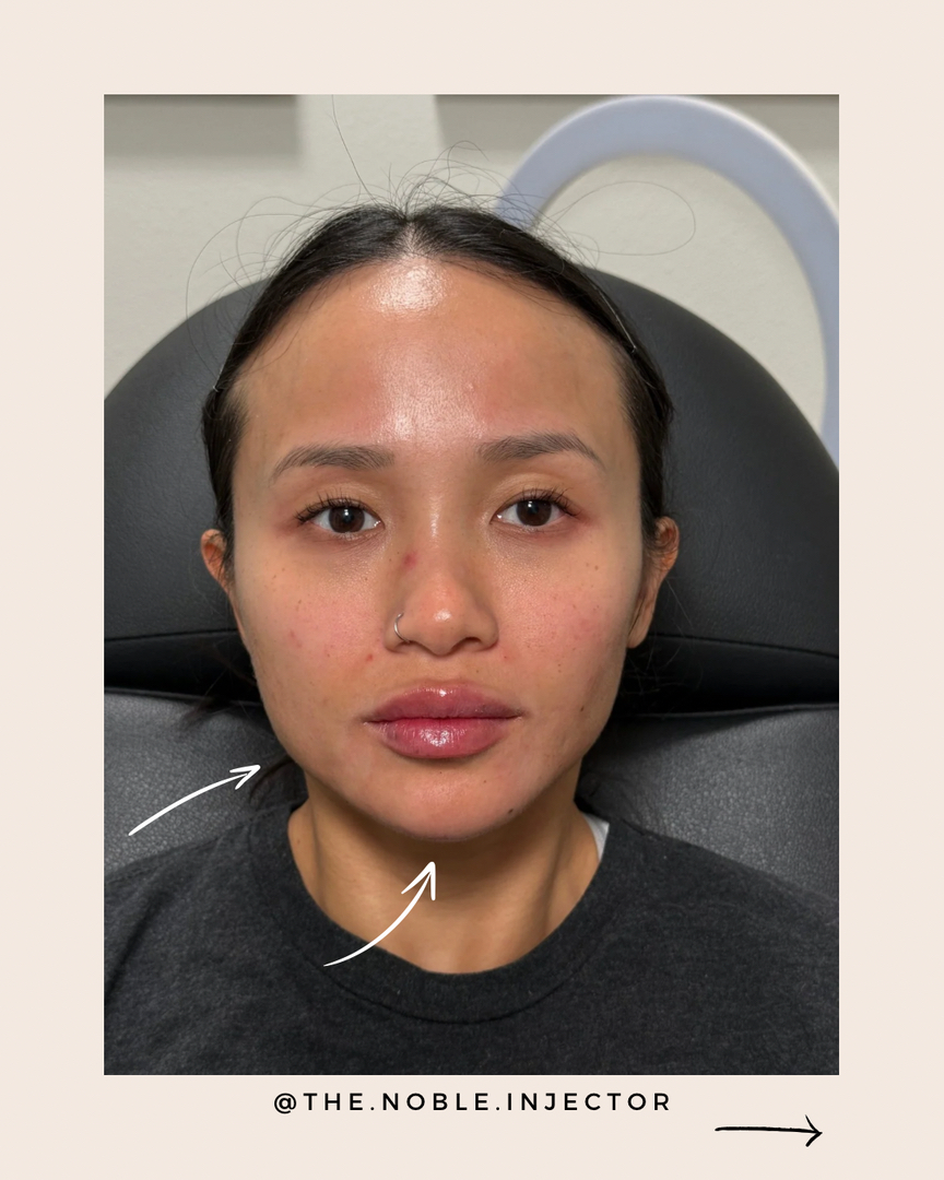 Noble Aesthetics Image