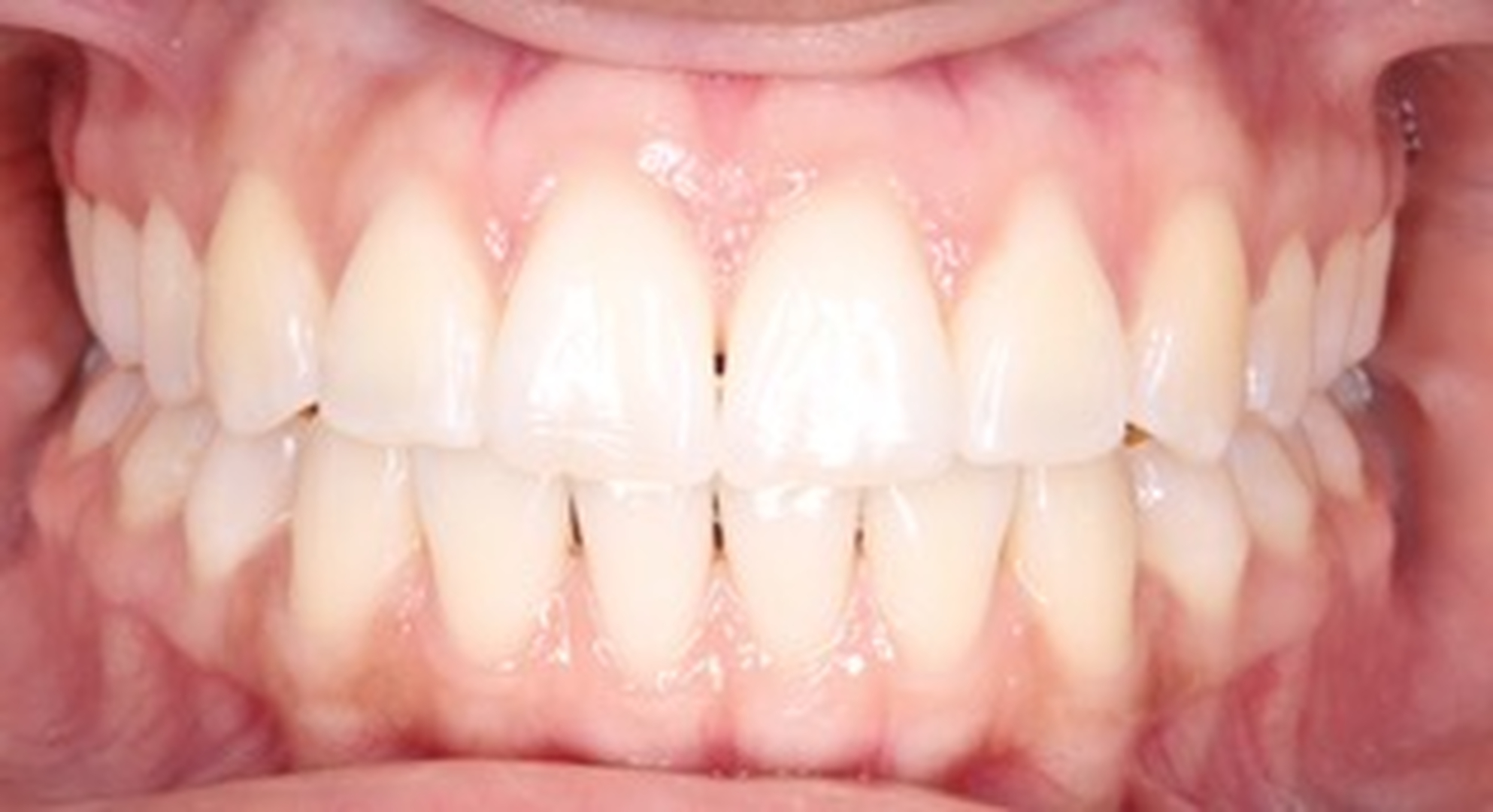 Boschetti Dental, PC Logo