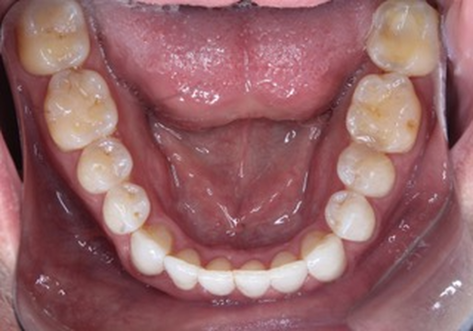 Boschetti Dental, PC Image