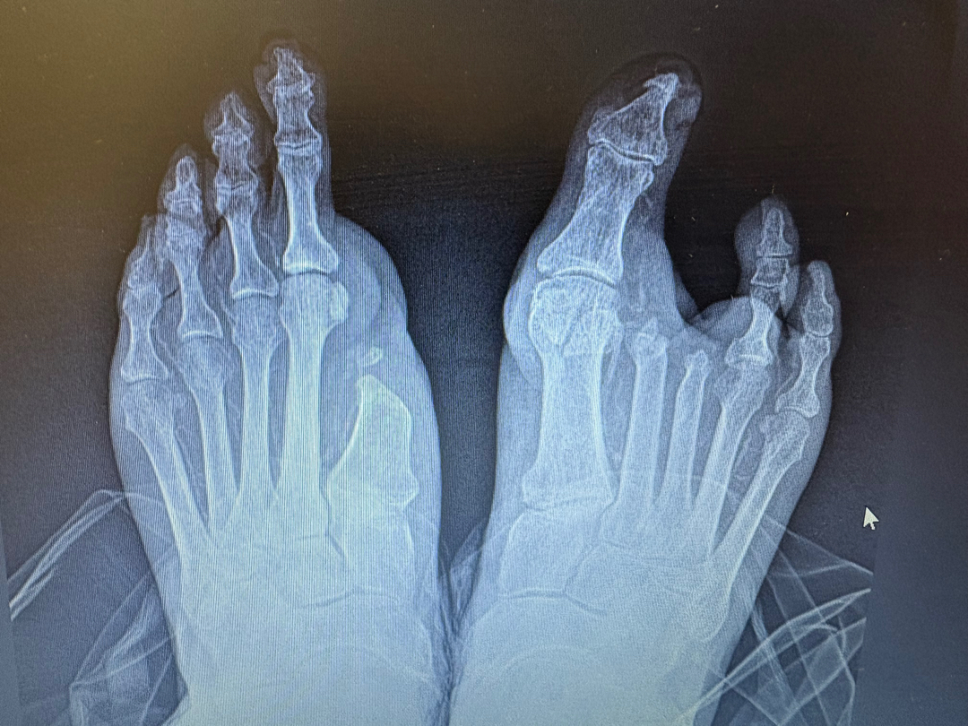 Flagstaff Foot Doctors: Anthony Rosales DPM - Flagstaff, AZ