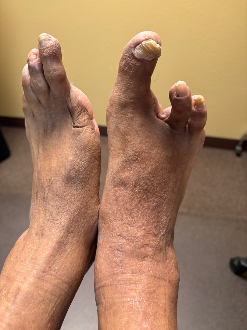 Flagstaff Foot Doctors: Anthony Rosales DPM - Flagstaff, AZ