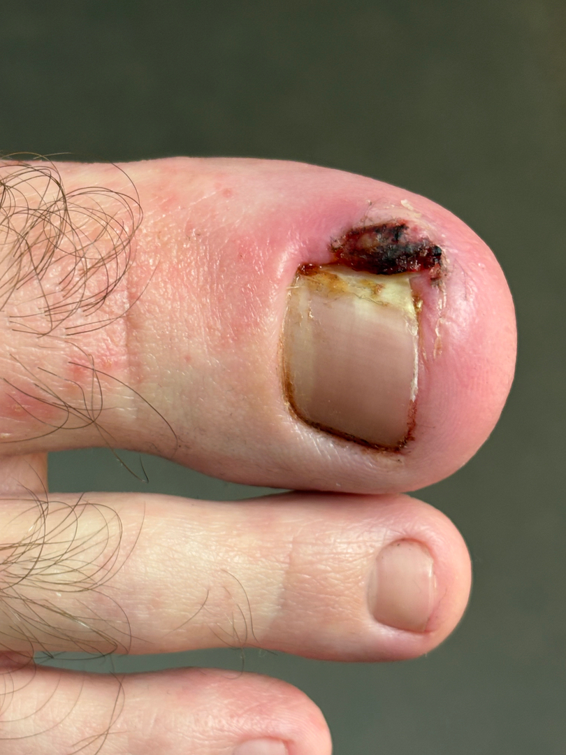 Flagstaff Foot Doctors: Anthony Rosales DPM - Flagstaff, AZ