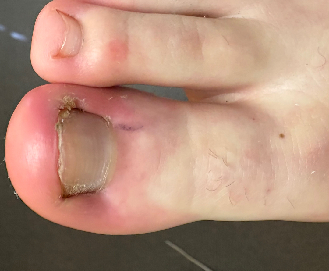 Flagstaff Foot Doctors: Anthony Rosales DPM - Flagstaff, AZ