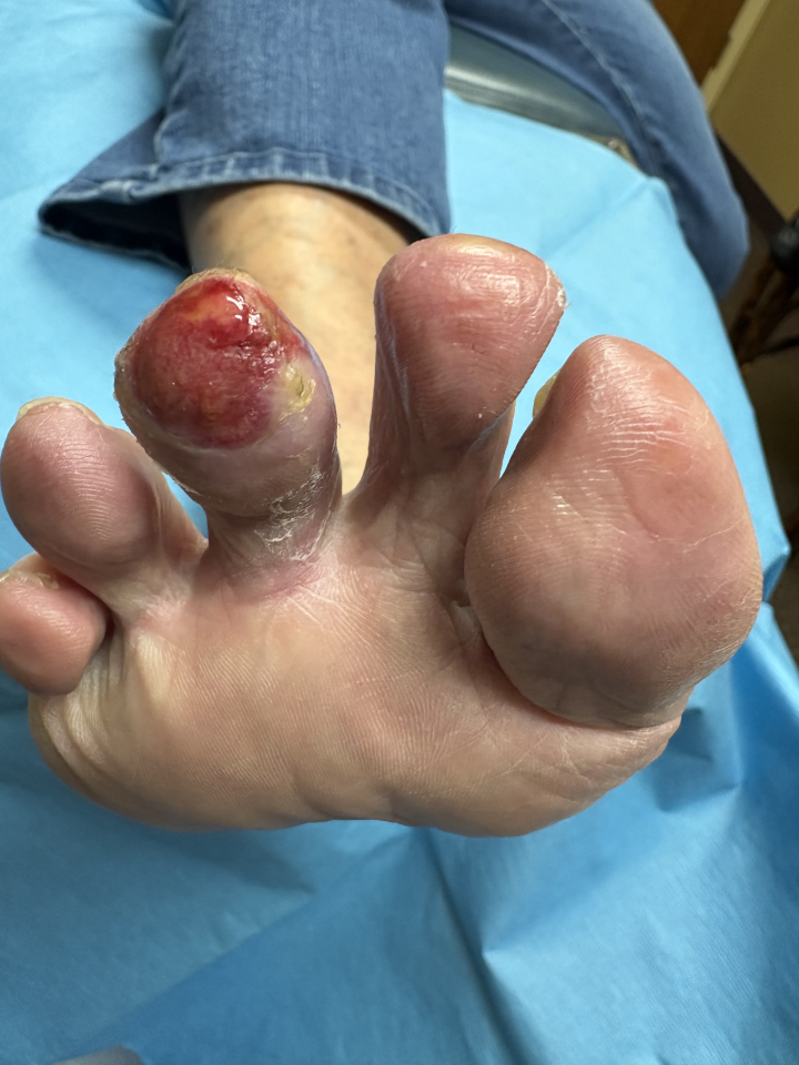 Flagstaff Foot Doctors: Anthony Rosales DPM - Flagstaff, AZ