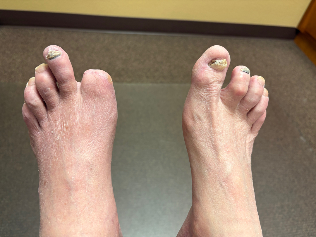 Flagstaff Foot Doctors: Anthony Rosales DPM - Flagstaff, AZ