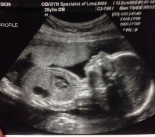 OBGYN Specialists of Lima Logo