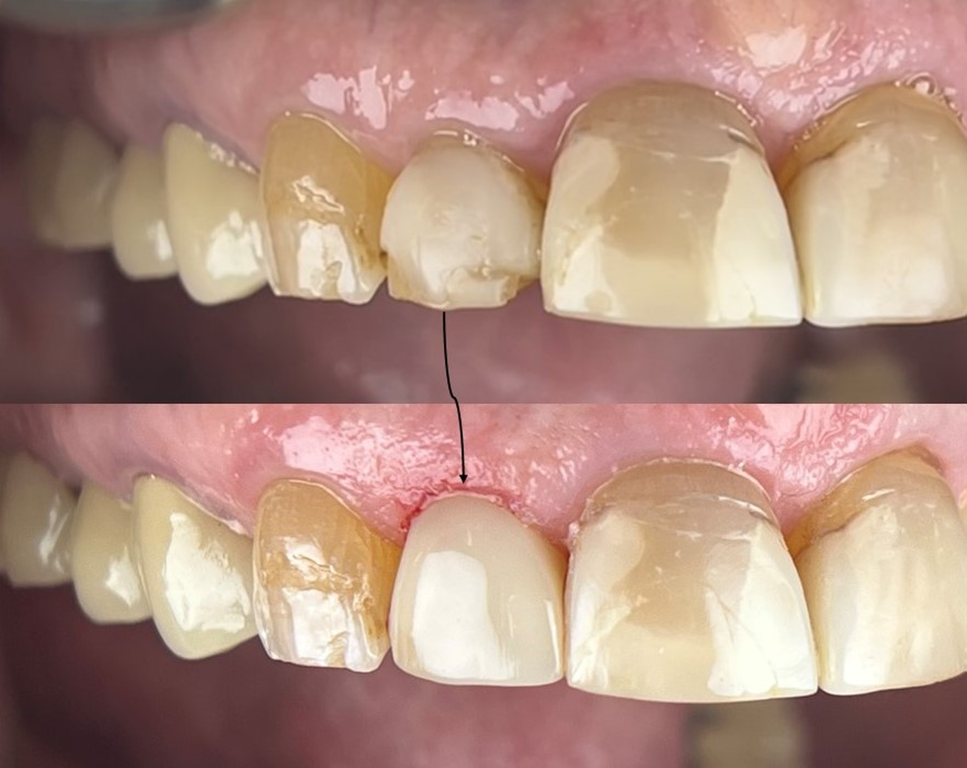 Idaho Family Dental Center - Coeur d Alene, ID