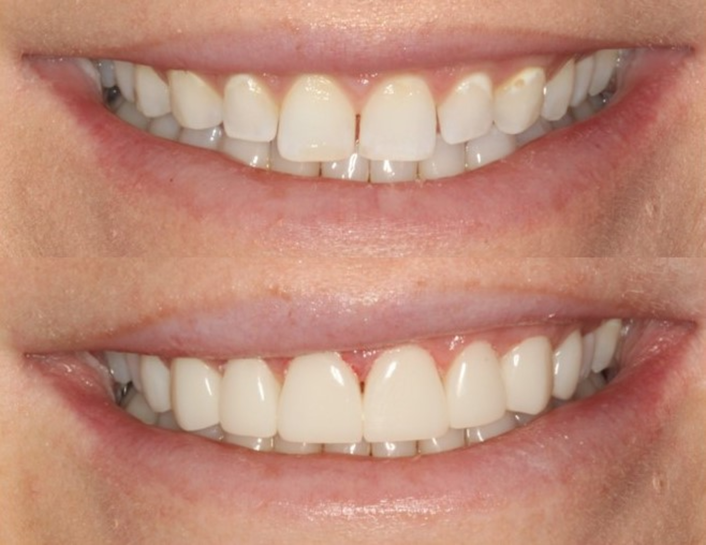 Idaho Family Dental Center - Coeur d Alene, ID