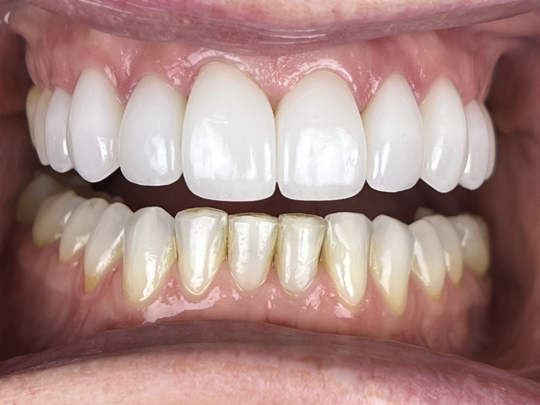 Idaho Family Dental Center - Coeur d Alene, ID