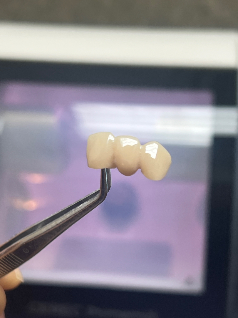 Idaho Family Dental Center - Coeur d Alene, ID