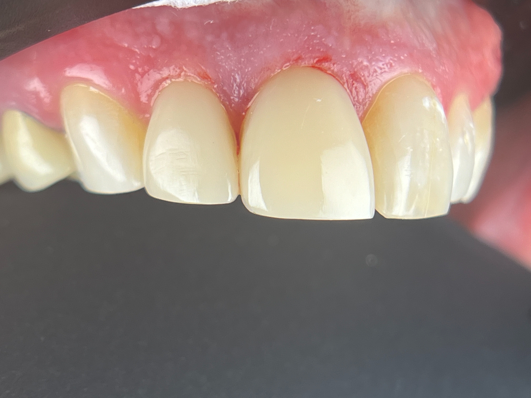 Idaho Family Dental Center - Coeur d Alene, ID