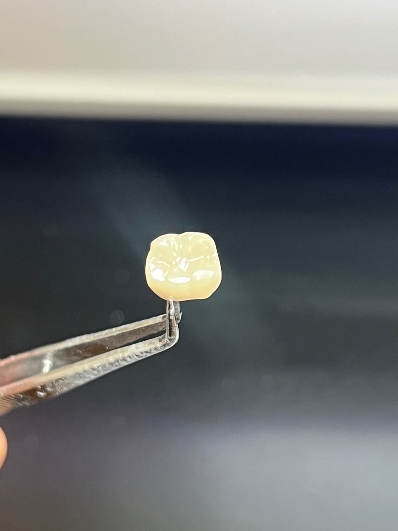 Idaho Family Dental Center - Coeur d Alene, ID