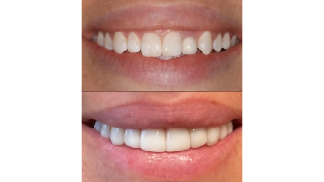 Idaho Family Dental Center - Coeur d Alene, ID