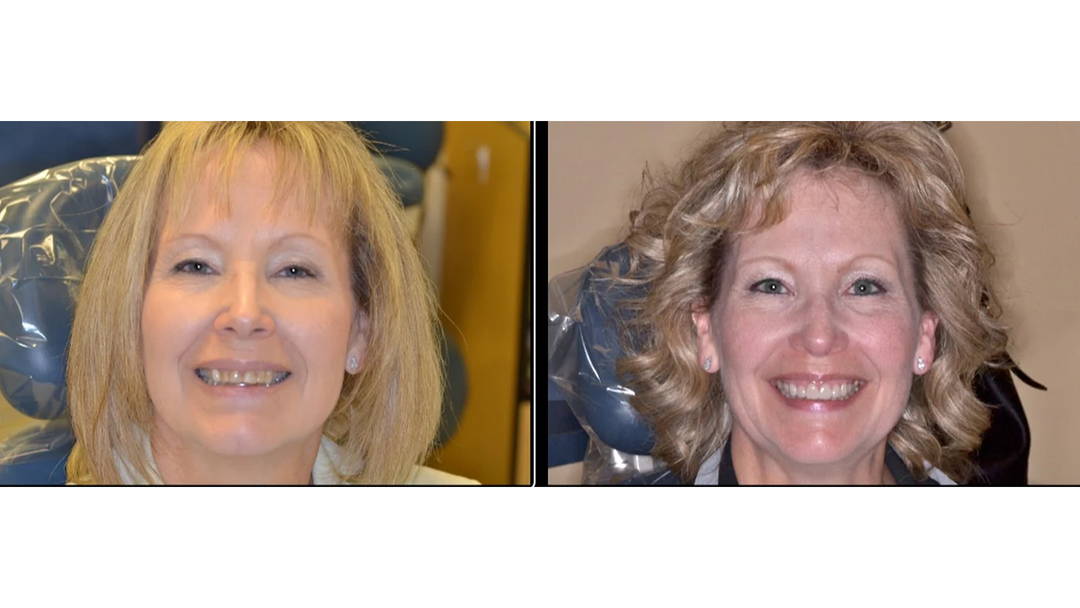 Idaho Family Dental Center, PLLC - Coeur d Alene, ID