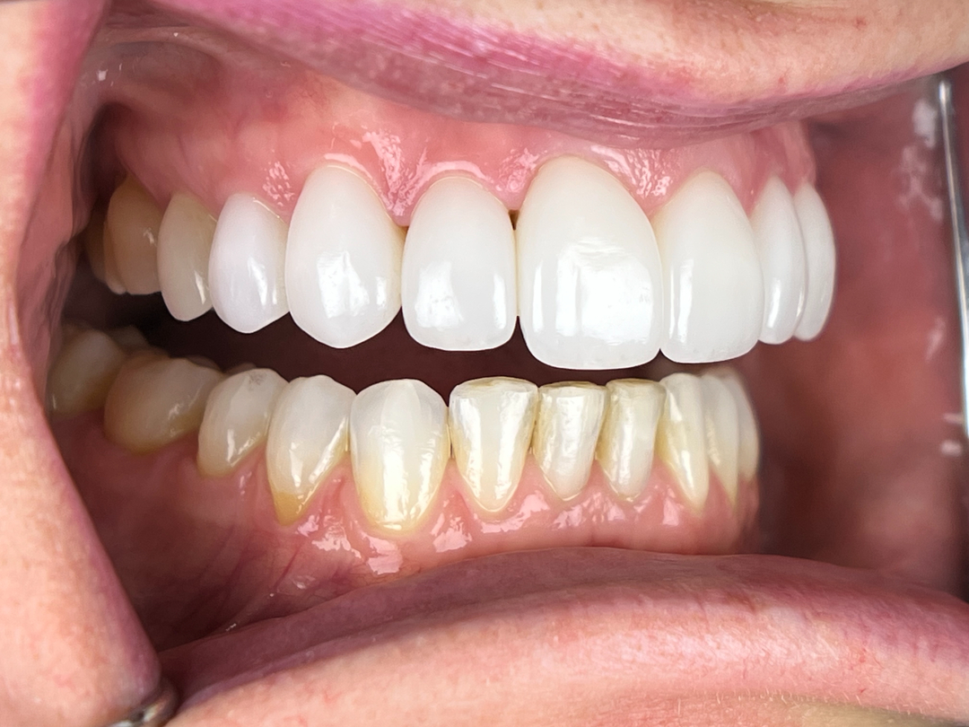 Idaho Family Dental Center - Coeur d Alene, ID