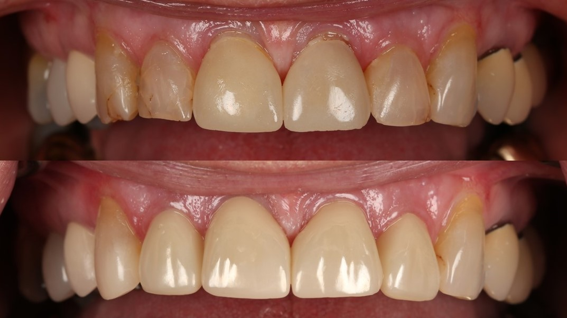 Idaho Family Dental Center - Coeur d Alene, ID