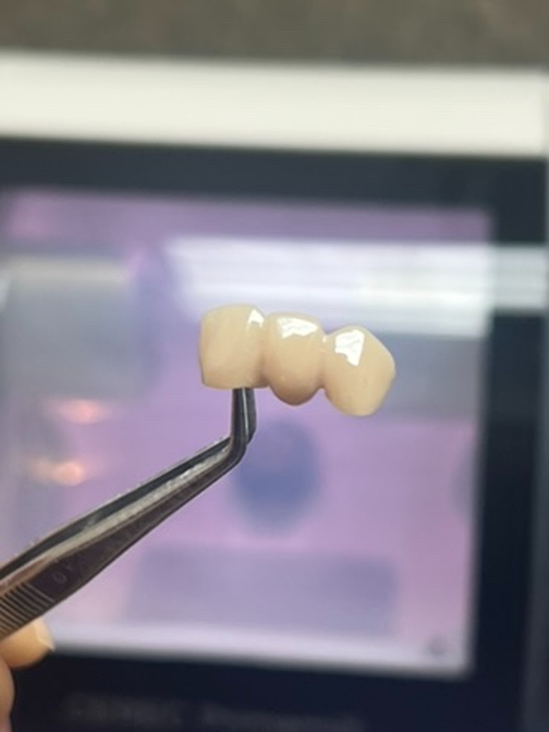 Idaho Family Dental Center - Coeur d Alene, ID