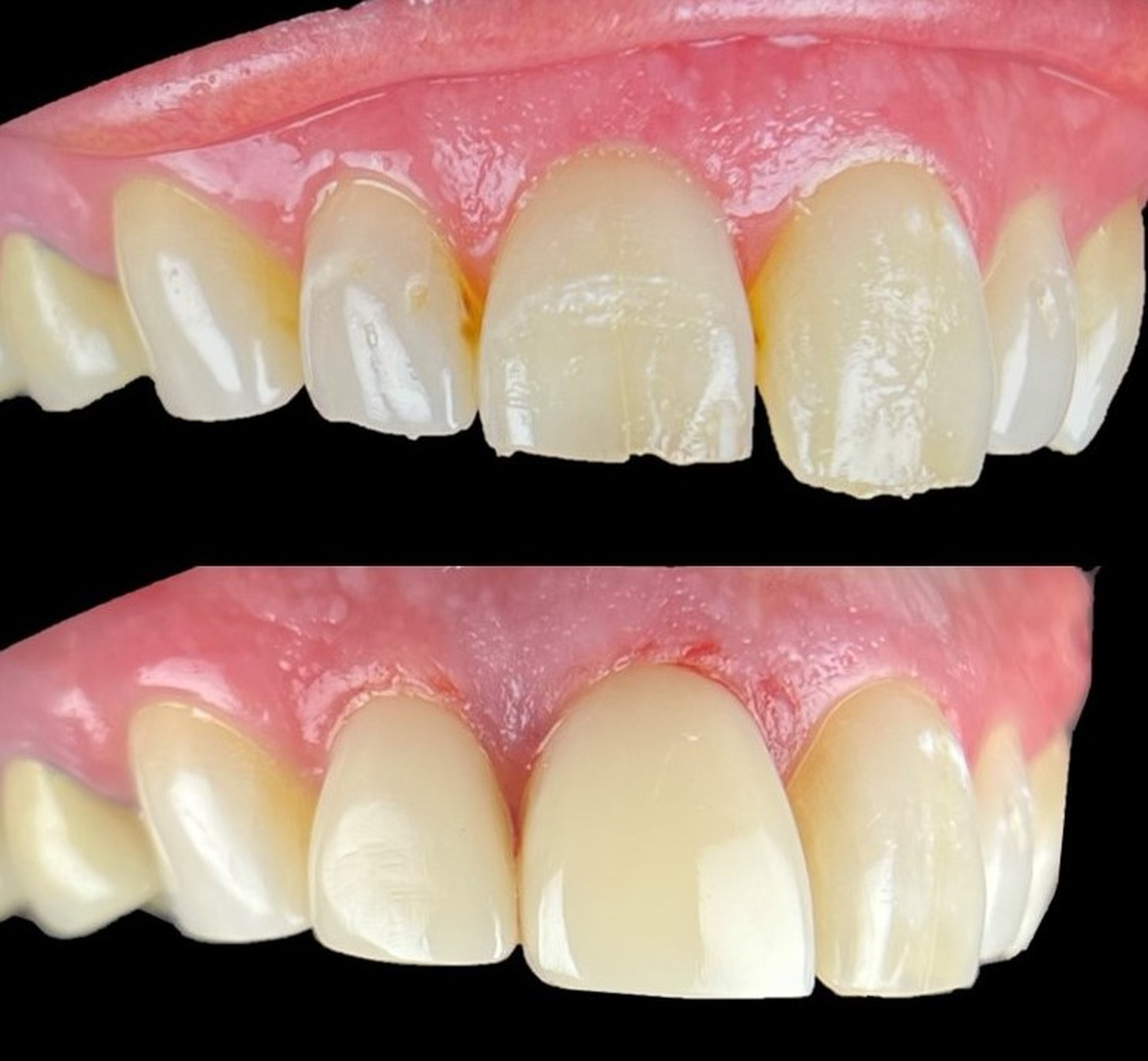 Idaho Family Dental Center - Coeur d Alene, ID