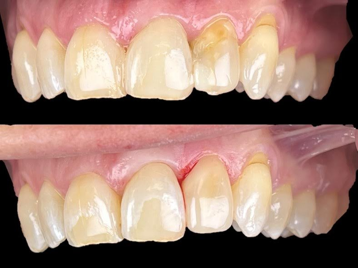 Idaho Family Dental Center - Coeur d Alene, ID