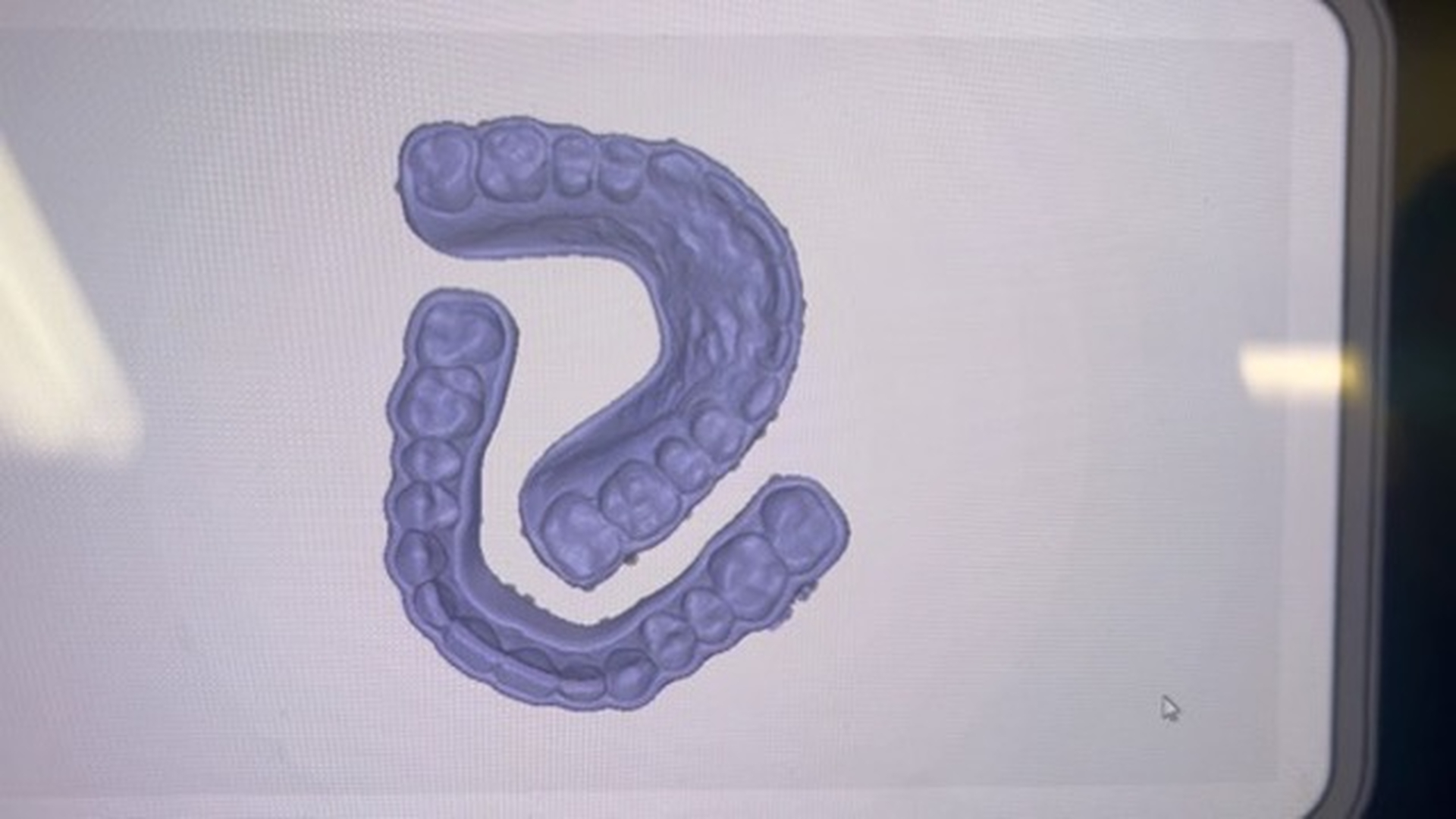 Idaho Family Dental Center - Coeur d Alene, ID