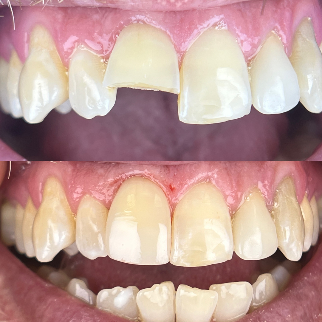 Idaho Family Dental Center - Coeur d Alene, ID