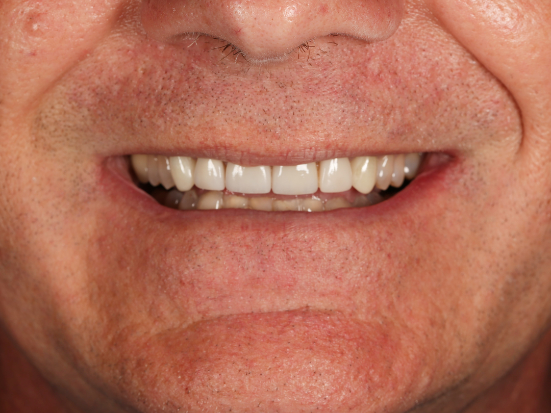 Idaho Family Dental Center - Coeur d Alene, ID