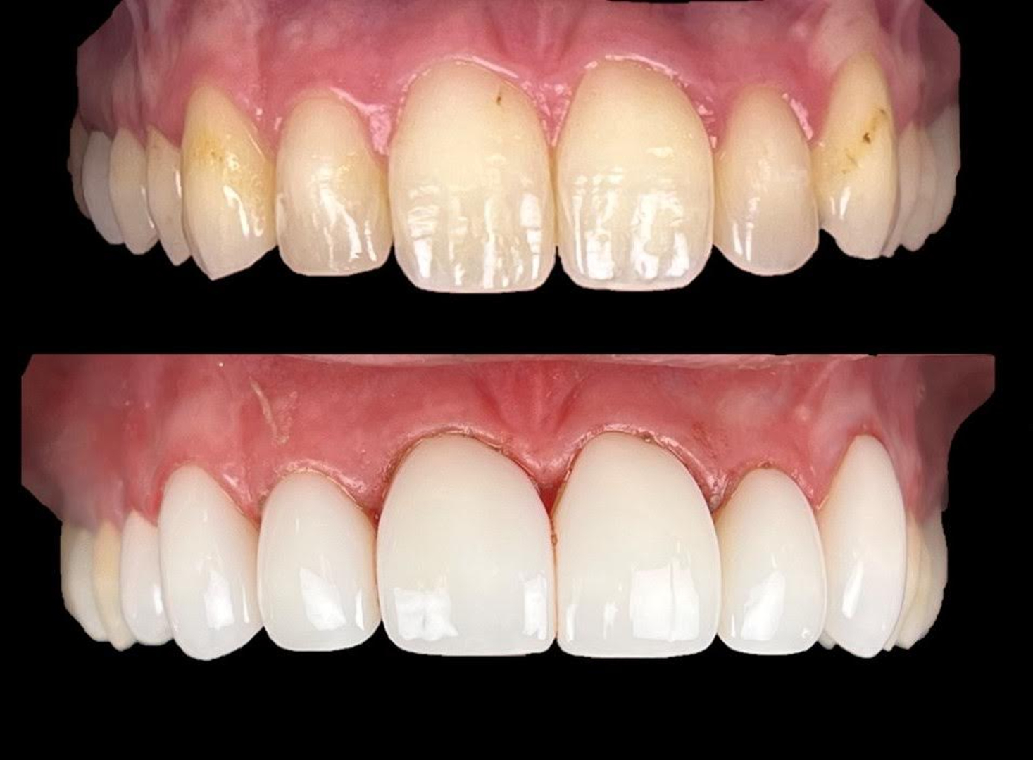 Idaho Family Dental Center - Coeur d Alene, ID