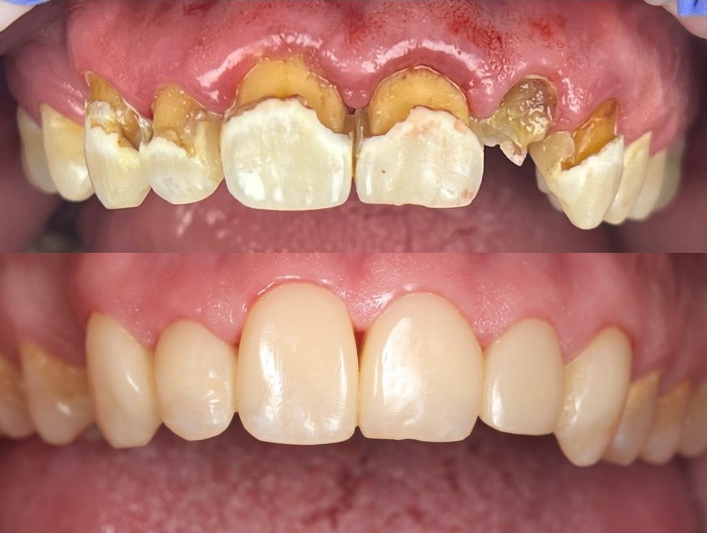 Idaho Family Dental Center - Coeur d Alene, ID