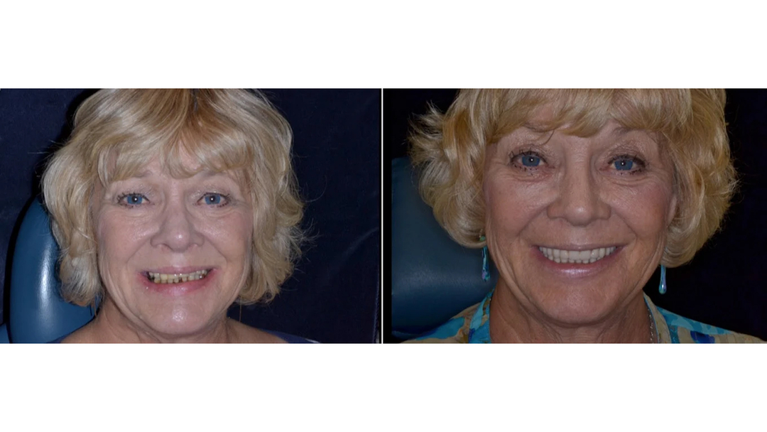 Idaho Family Dental Center, PLLC - Coeur d Alene, ID
