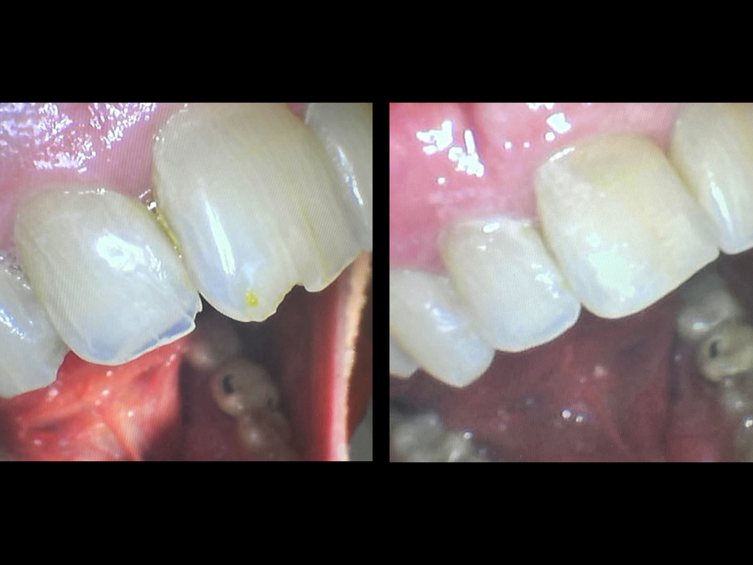 Idaho Family Dental Center - Coeur d Alene, ID