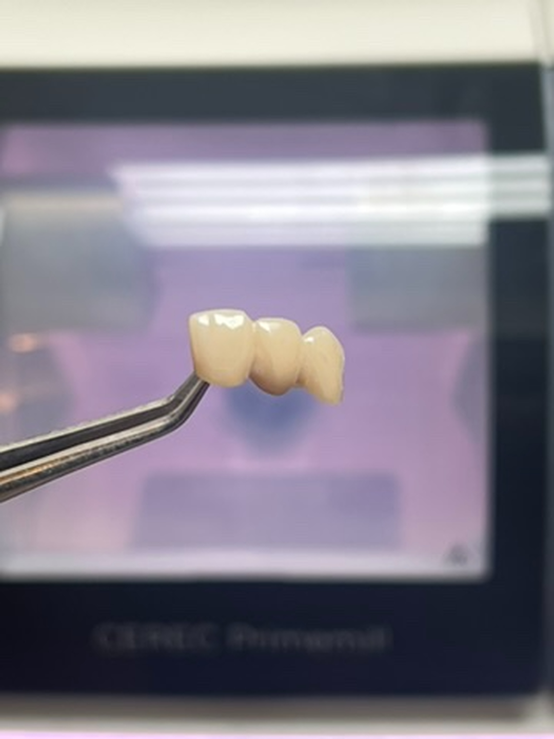 Idaho Family Dental Center - Coeur d Alene, ID