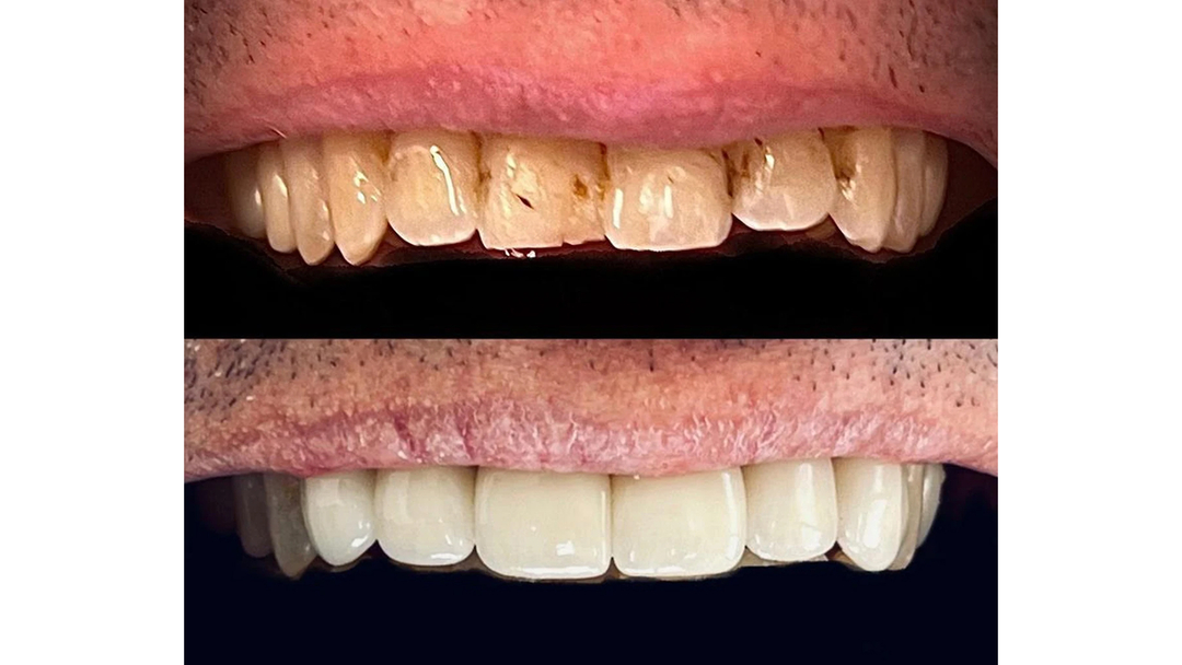 Idaho Family Dental Center, PLLC - Coeur d Alene, ID