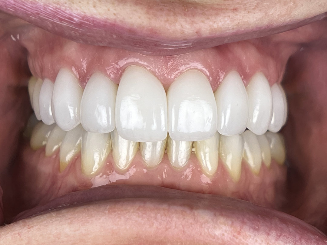 Idaho Family Dental Center - Coeur d Alene, ID