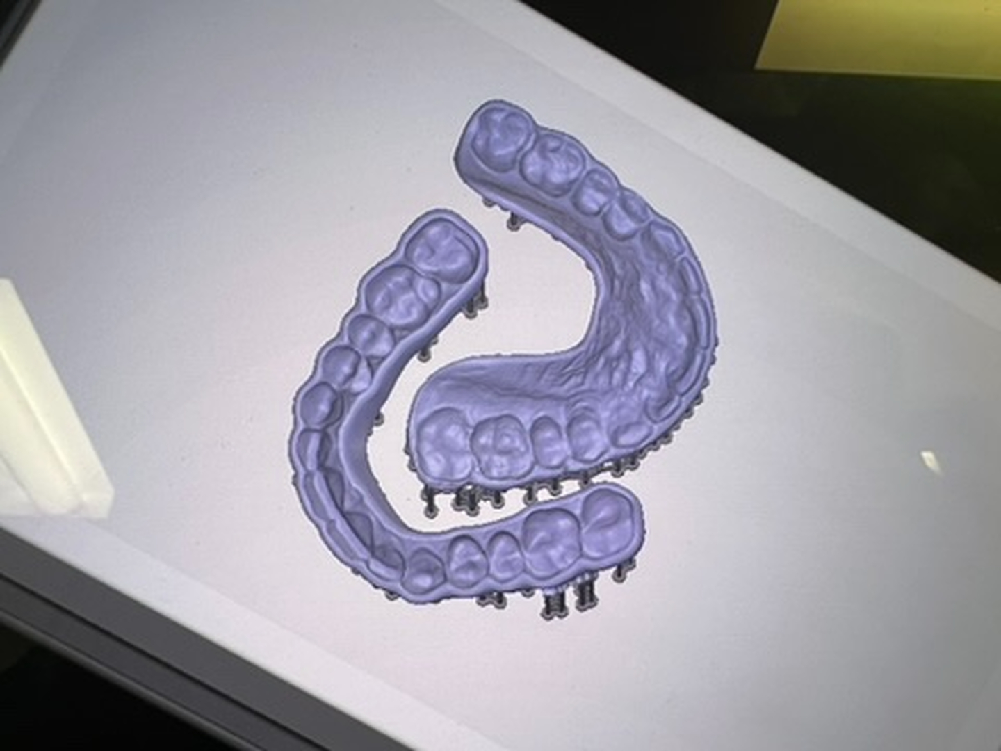 Idaho Family Dental Center - Coeur d Alene, ID