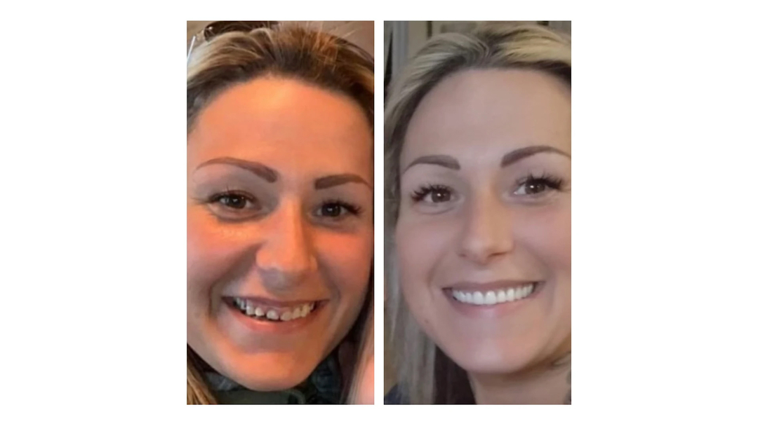 Idaho Family Dental Center, PLLC - Coeur d Alene, ID