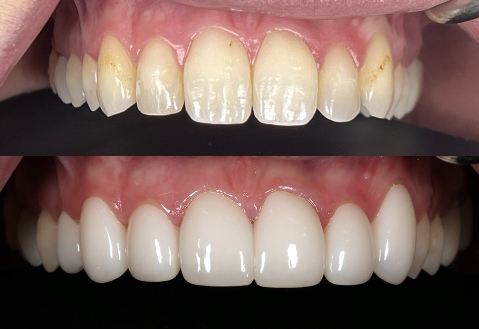 Idaho Family Dental Center, PLLC - Coeur d Alene, ID