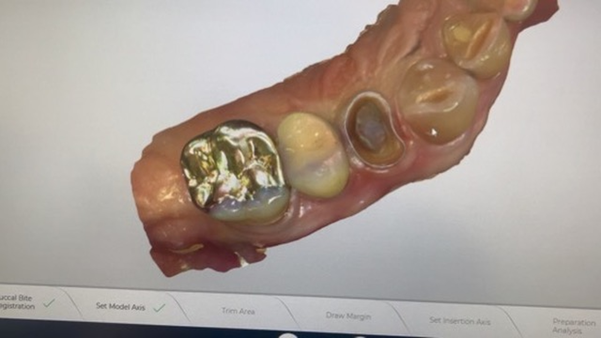 Idaho Family Dental Center - Coeur d Alene, ID