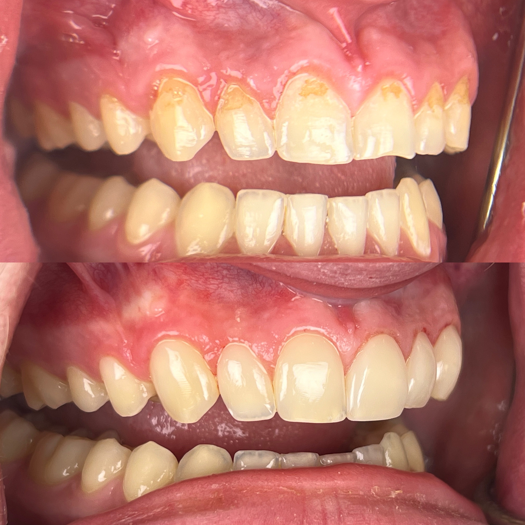 Idaho Family Dental Center - Coeur d Alene, ID