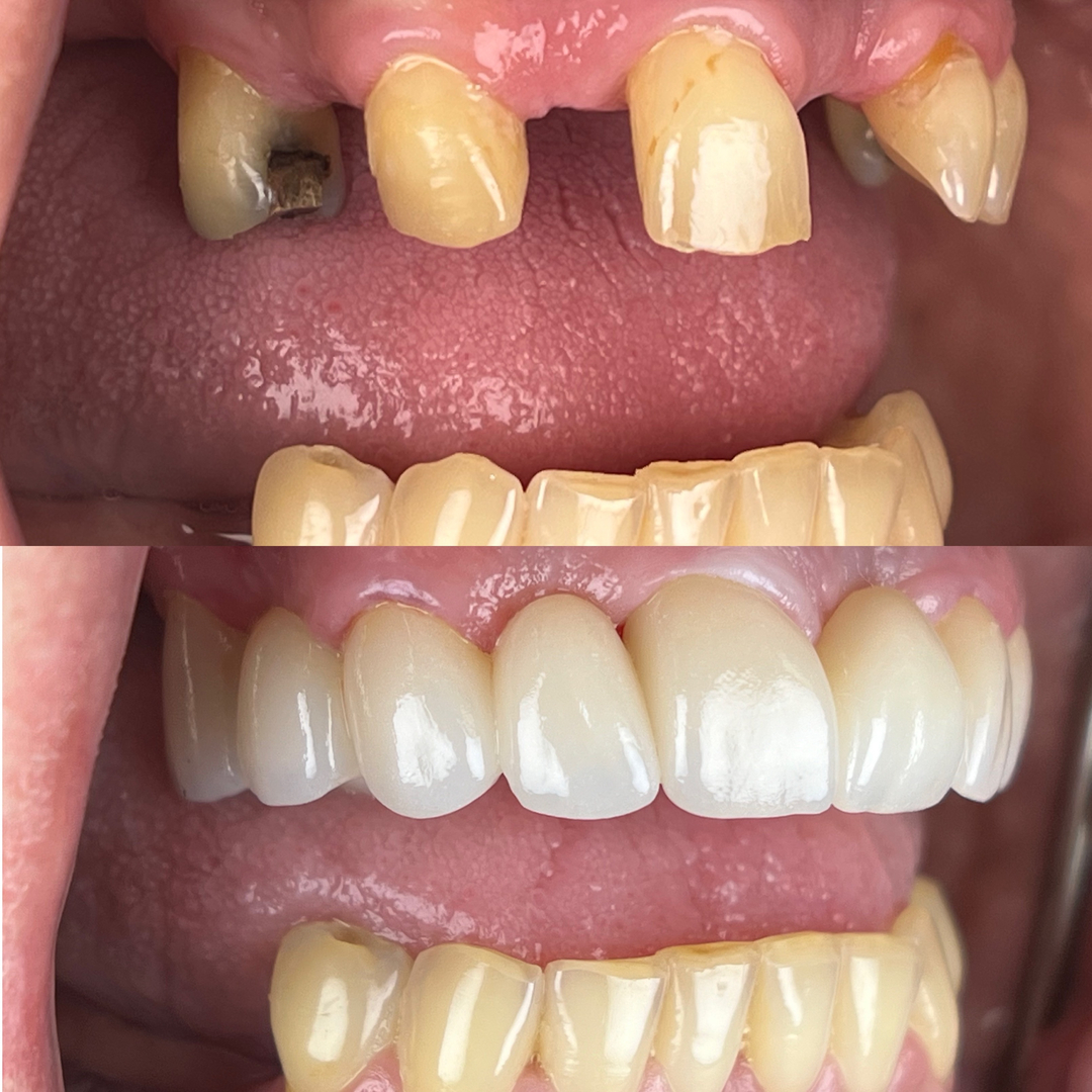 Idaho Family Dental Center - Coeur d Alene, ID