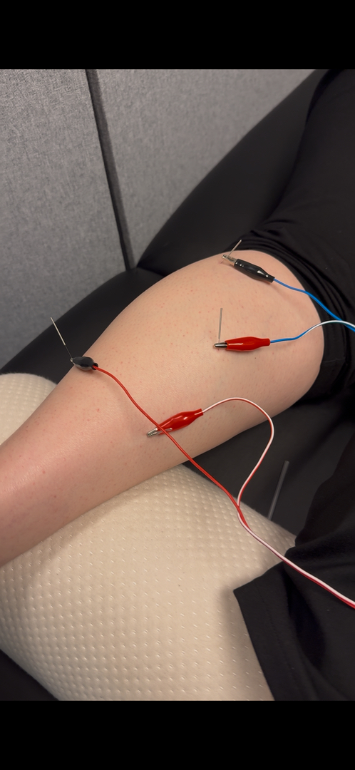 E.S.C.O. | Elite Sport Chiropractic Optimization - Fort Mill, SC