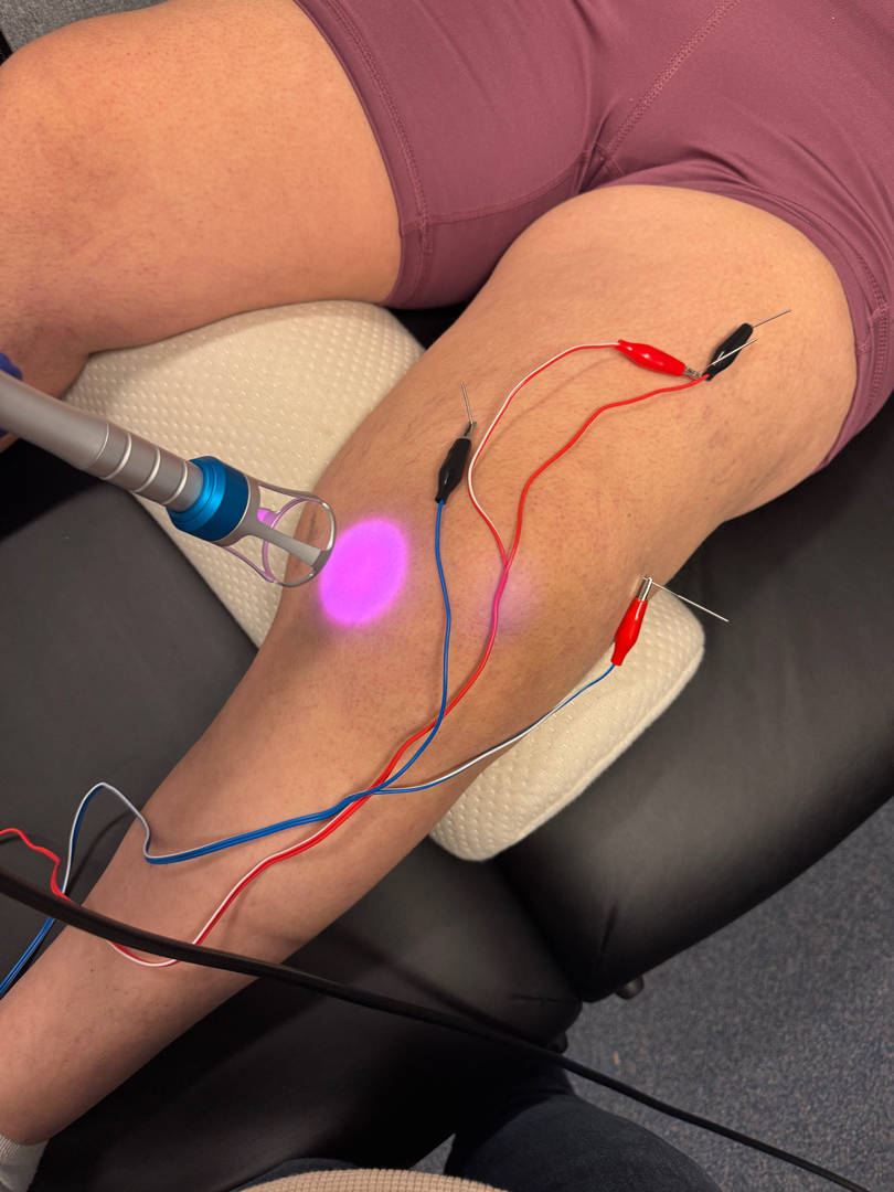 E.S.C.O. | Elite Sport Chiropractic Optimization - Fort Mill, SC