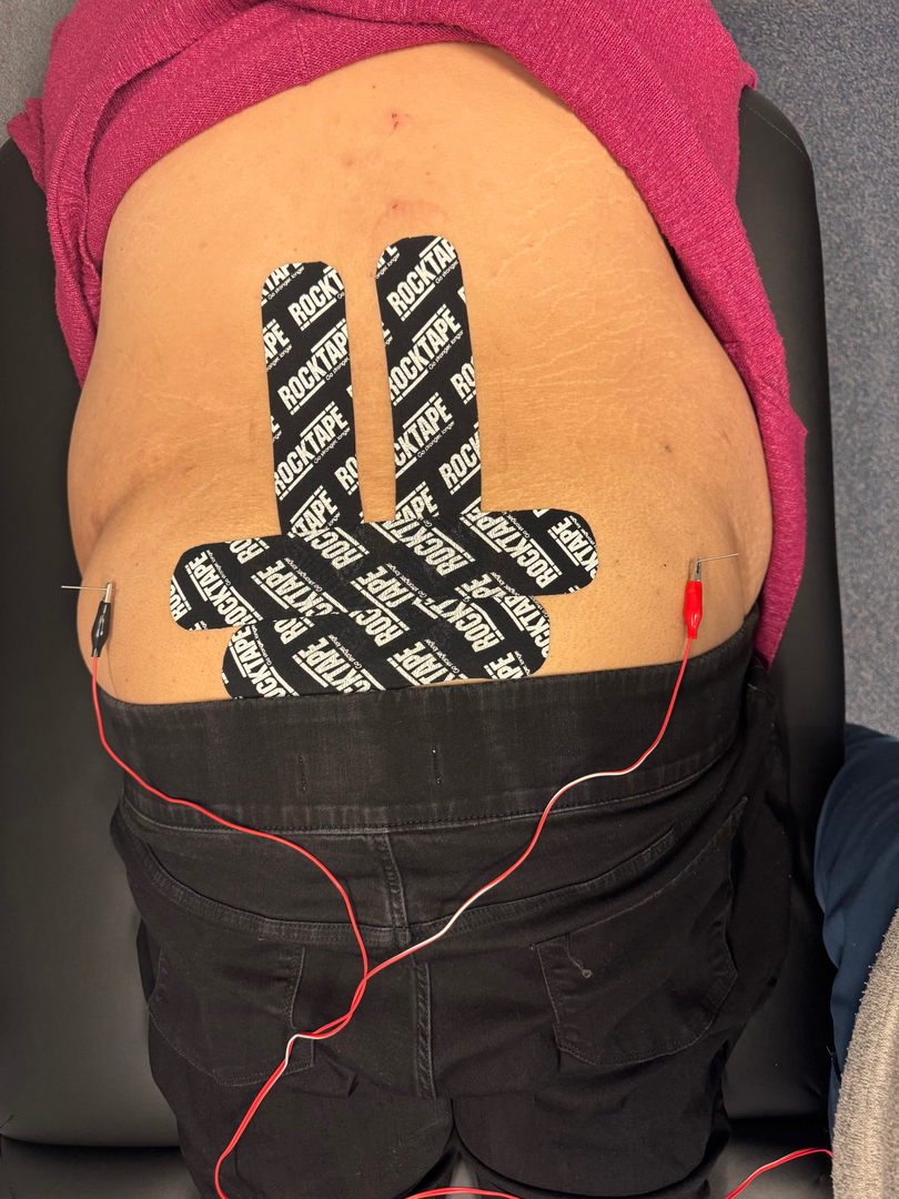 E.S.C.O. | Elite Sport Chiropractic Optimization Image