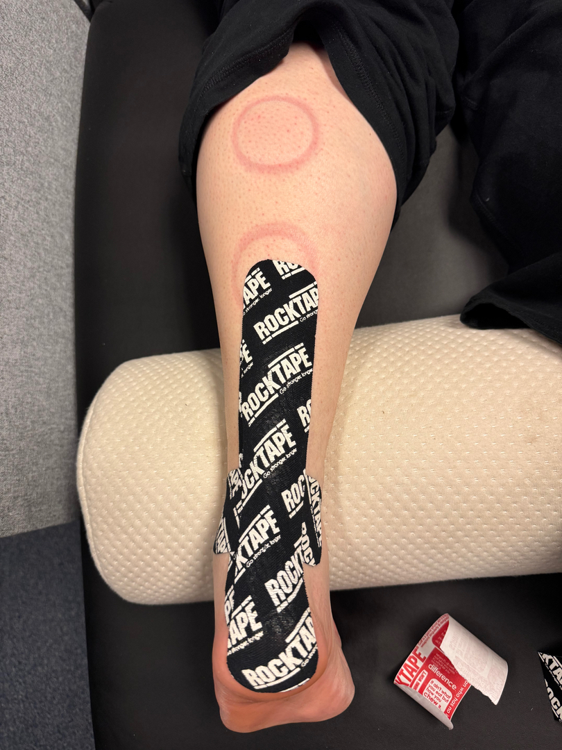 E.S.C.O. | Elite Sport Chiropractic Optimization - Fort Mill, SC