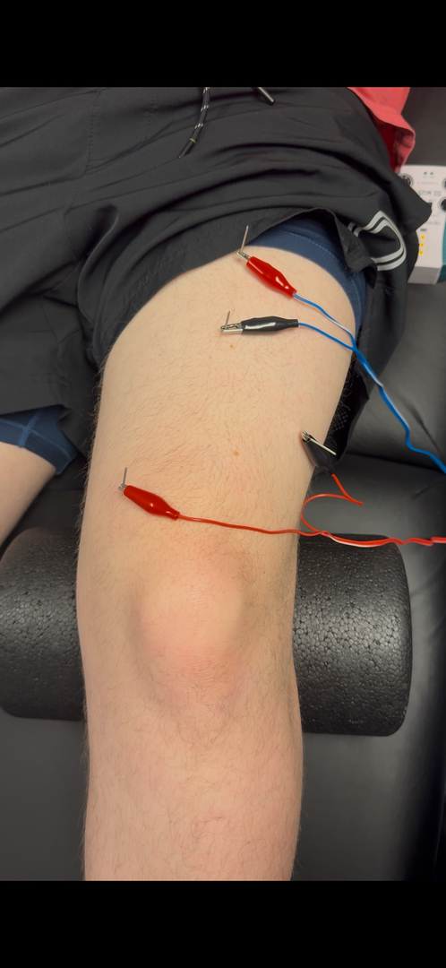 E.S.C.O. | Elite Sport Chiropractic Optimization - Fort Mill, SC