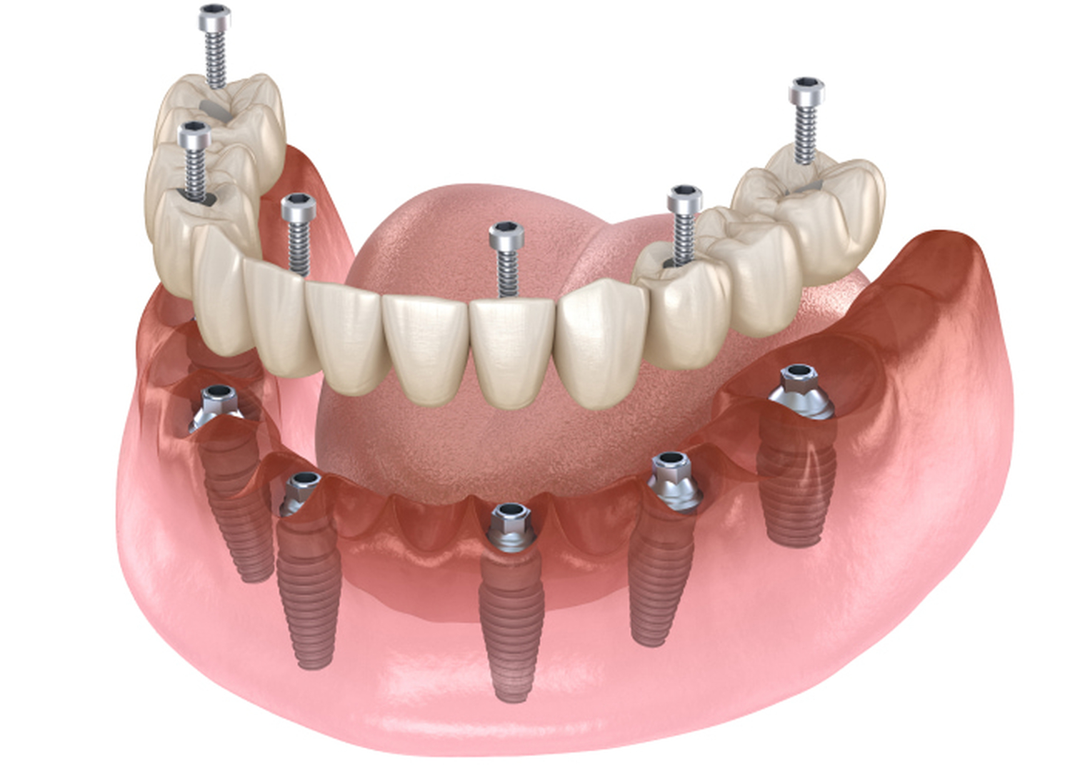 SmileCentric - Cosmetic Dentist / Dental Implant Center Image