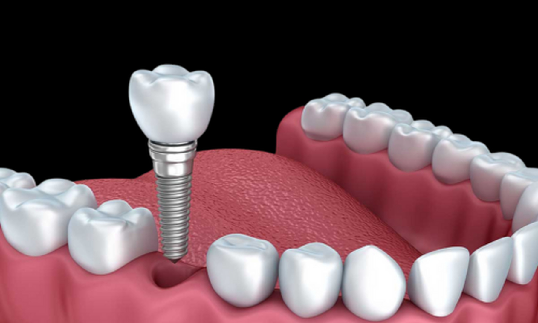 SmileCentric - Cosmetic Dentist / Dental Implant Center Image